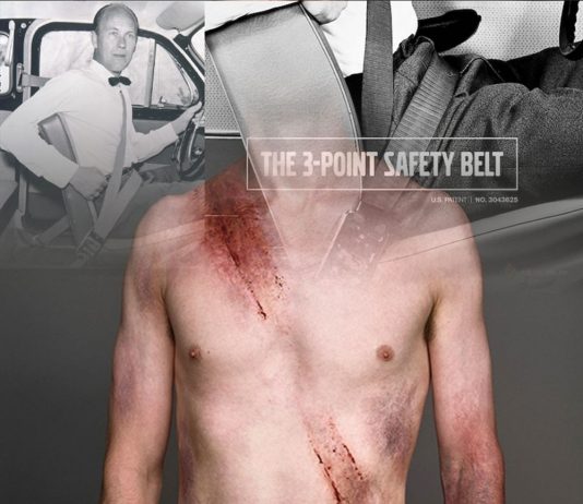 Emniyet Kemeri Yaralanması