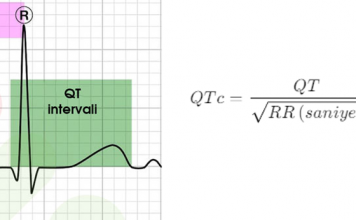 Düzeltilmiş QT Hesaplama