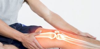 Patella Kırıkları ve Çıkıkları