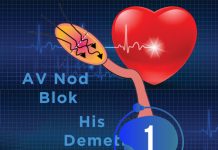 1. Derece Atriyoventriküler (AV) Blok