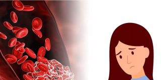 Trombotik Trombositopenik Purpura (TTP)