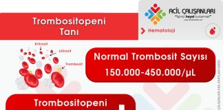 Trombositopeni Acil Yaklaşım