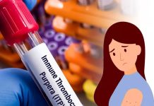 İdiyopatik Trombositopenik Purpura (İTP)