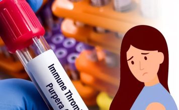 İdiyopatik Trombositopenik Purpura (İTP)