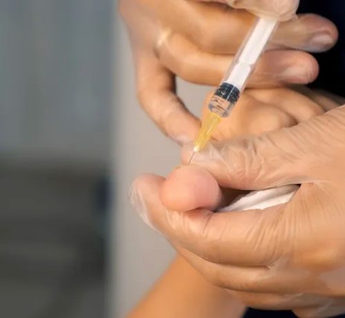 Lokal Anestezik Toksitesi