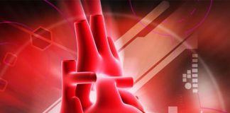 Wolf Parkinson White (WPW) Sendromu