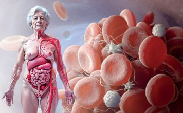 Dissemine İntravasküler Koagülasyon (DİK)