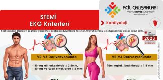 Koroner Arter Akut Oklüzyonunu Düşündüren ST Segment Elevasyonu (STEMİ) Akıl Kartı