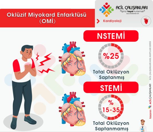 Oklüzif Miyokard Enfarktüsü (OMİ)