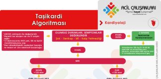 Taşikardi Algoritması