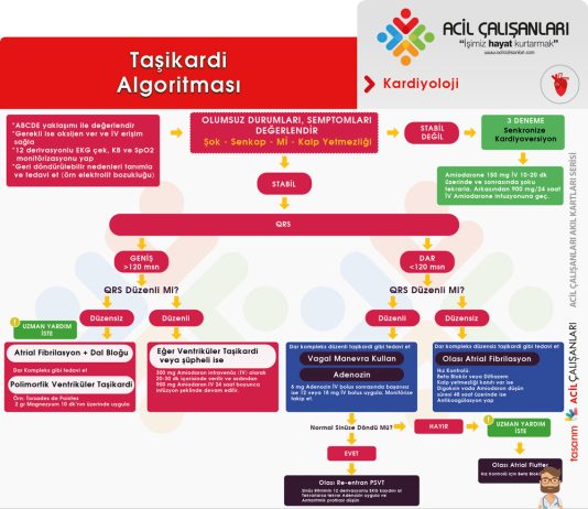 Taşikardi Algoritması