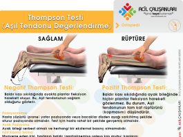 Thompson Testi (Aşil Tendonu Değerlendirme)