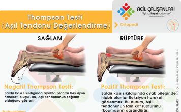 Thompson Testi (Aşil Tendonu Değerlendirme)