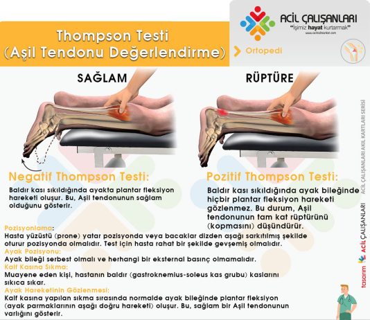 Thompson Testi (Aşil Tendonu Değerlendirme)