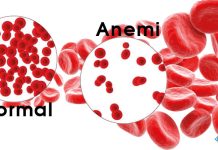 Anemi Acil Yaklaşım