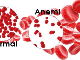 Anemi Acil Yaklaşım