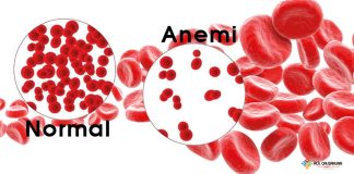 Anemi Acil Yaklaşım