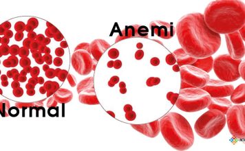 Anemi Acil Yaklaşım