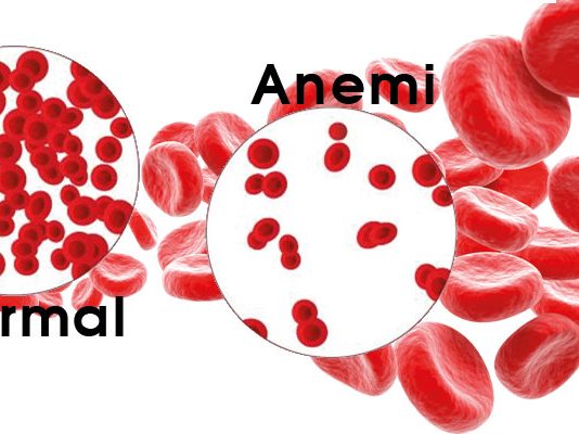 Anemi Acil Yaklaşım
