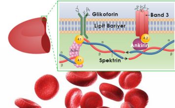 Herediter Sferositoz
