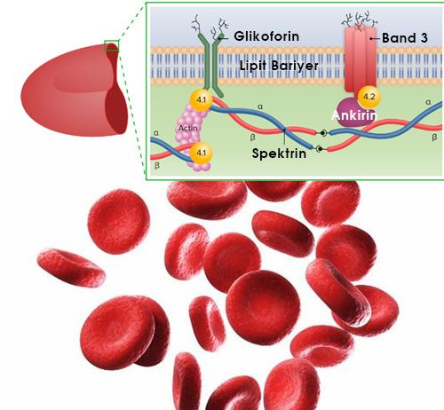 Herediter Sferositoz
