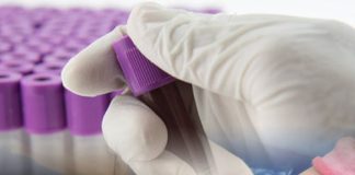 Tam Kan Sayımı (Hemogram)