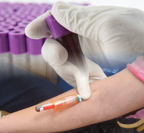 Tam Kan Sayımı (Hemogram)