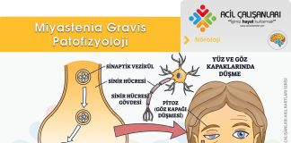 Acil Serviste Miyastenik Kriz Yönetimi