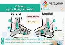 Ottowa Ayak Bileği Kriterleri