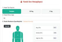 Yanık Sıvı Hesapla
