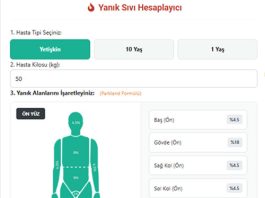 Yanık Sıvı Hesapla