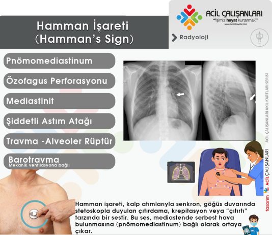 Hamman İşareti (Hamman’s Sign)