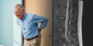 Kauda Ekuina ve Konus Medullaris Sendromları