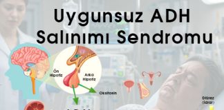 Uygunsuz ADH Salınımı Sendromu