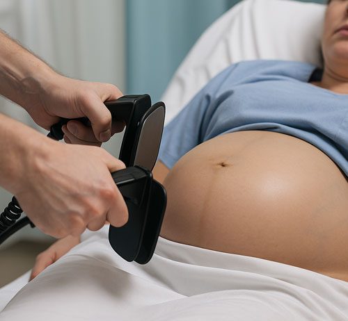 Gebelerde Elektriksel Kardiyoversiyon