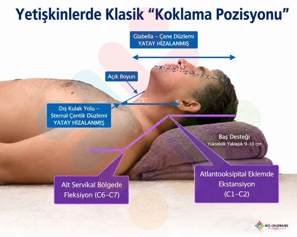 Koklama pozisyonunda havayolu aksları