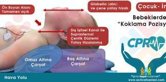 Bebek ve Çocuklarda Hava Yolu Yönetimi İçin Pozisyon Verme