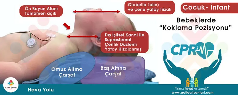 Bebek Hava Yolu Yönetimi