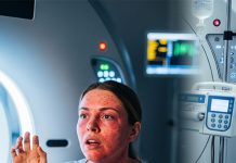 Kontrast Madde Alerjisi