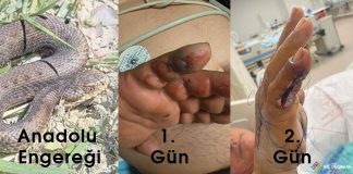 65 Yaş Yılan Isırma Olgusu