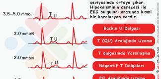 Hipopotasemi (Hipokalemi) Acil Yaklaşım