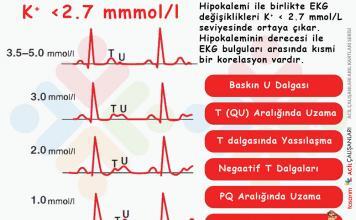 Hipopotasemi (Hipokalemi) Acil Yaklaşım