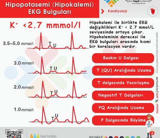 Hipopotasemi (Hipokalemi) Acil Yaklaşım