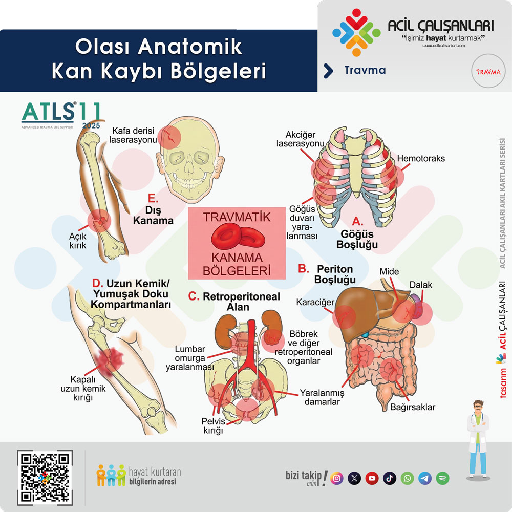 Olası Anatomik Kan Kaybı Bölgeleri