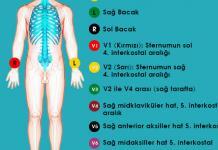 EKG’de Artefaktlar ve Yanlış Yerleştirme
