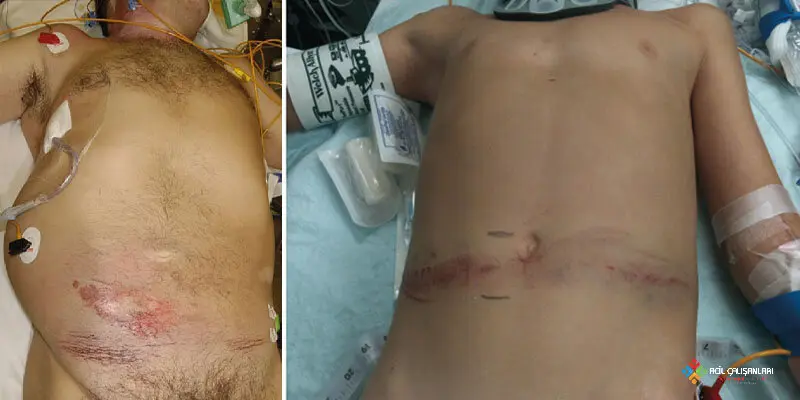 Künt Batın Travması Banner