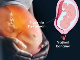 Ablasyo Plasenta (Plasenta Dekolmanı) Acil Yaklaşım