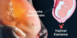 Ablasyo Plasenta (Plasenta Dekolmanı) Acil Yaklaşım