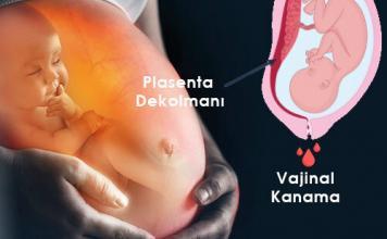 Ablasyo Plasenta (Plasenta Dekolmanı) Acil Yaklaşım