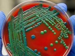 Metisiline Dirençli Staphylococcus Aureus (MRSA) Enfeksiyonu